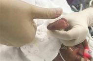 南京“巴掌宝宝”经百天救治出院 出生体重1.1斤