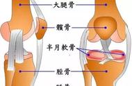 膝盖不舒服、痛到底是什么病？这里有6种诊断和康复方法