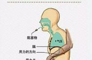 孩子异物卡喉：别拍背部！救人无数的海姆立克急救法一招搞定！