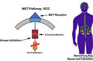 一文带您掌握MET驱动突变实体瘤分子诊断及靶向治疗