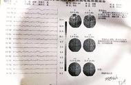 大学生被关精神病院134天？想逃又无法证明自己正常