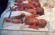 伊拉克25岁女子顺产生下7胞胎，是该国第一次七胎分娩案例