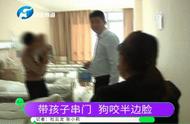 13个月孩子被狗咬掉半边脸 狗主人：我的狗没咬过人