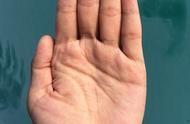 为什么手掌反复脱皮瘙痒？除了湿疹，还和哪些因素有关？