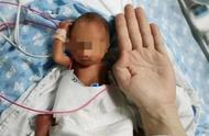 超早产“巴掌宝宝”，115天生命闯关！看哭了……