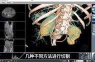 模拟人体还原真实手术训练