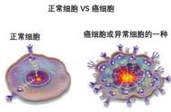 100年前的人类预测2023年：癌症被消除，人可以活到300岁